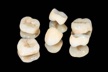 zirkonyum diş taç makro. Siyah bir arka plan üzerinde yalıtın. Aest