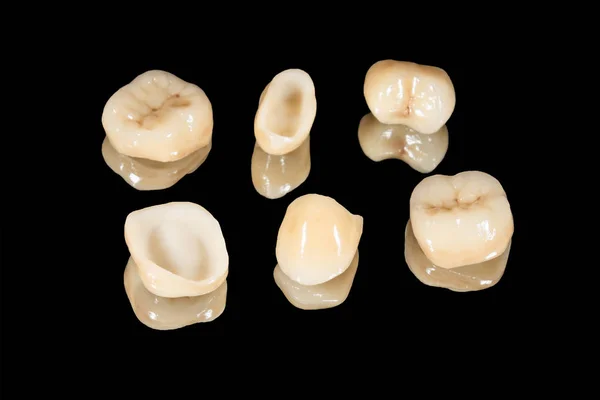 Korony ceramiczne ludzkich zębów zbliżenie makro izolat na czarnym b — Zdjęcie stockowe