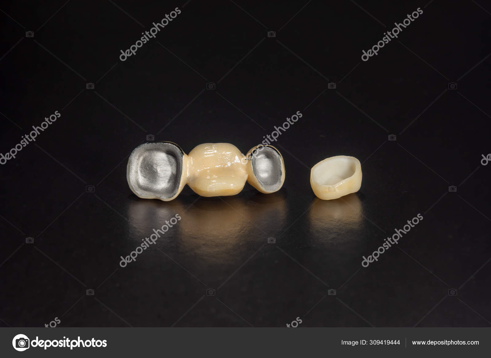 Dental veneers, ceramic and zirconium crowns of teeth closeup m Stock