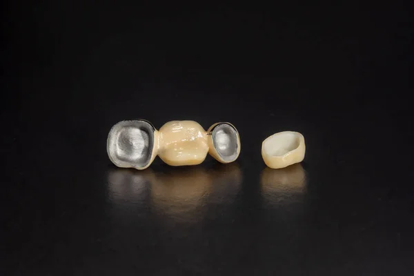 Folheados dentários, coroas de cerâmica e zircónio dos dentes close-up m — Fotografia de Stock