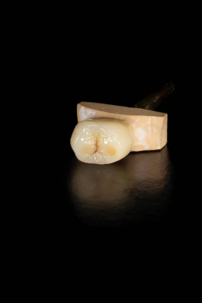 치아 클로즈업 m의 치과 베니어, 세라믹 및 지르코늄 크라운 — 스톡 사진