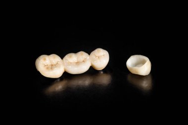 insan dişlerinin seramik kron closeup makro siyah bac izole