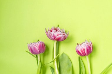 Yeşil arka planda yatan üç Pembe lale çiçekleri.