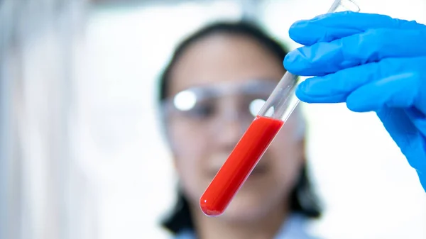 Investigadores Laboratorio Gotean Sangre Tubo Ensayo Para Detectar Virus — Foto de Stock