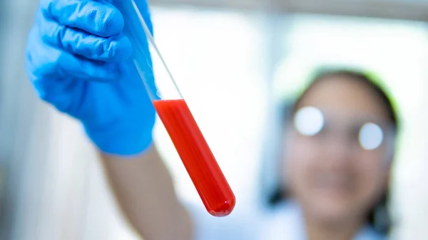 Investigadores Laboratorio Gotean Sangre Tubo Ensayo Para Detectar Virus — Foto de Stock