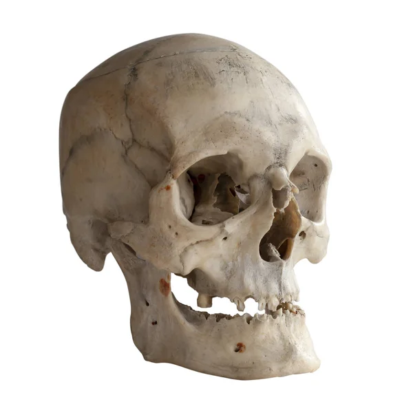 Crânio Humano Isolado Branco Close — Fotografia de Stock