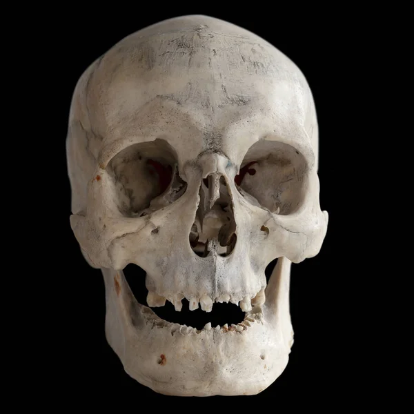 Human Skull Isolated Black Close — Stock Photo, Image