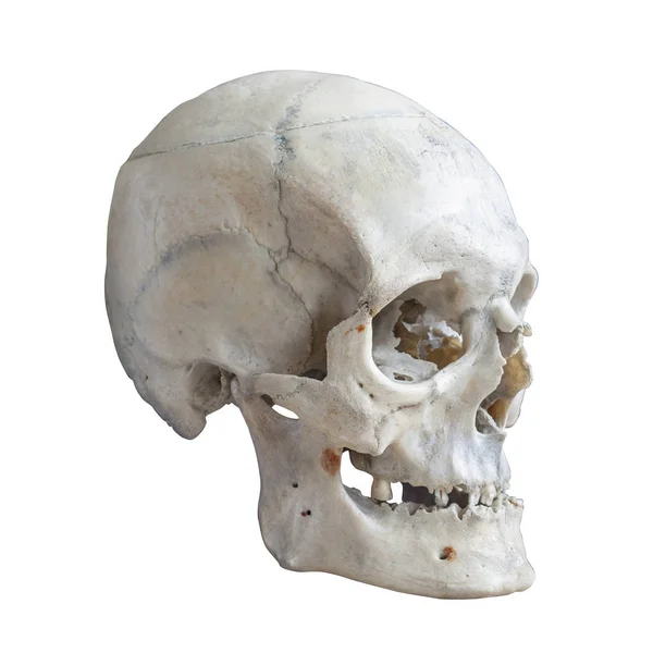 Crânio Humano Isolado Branco — Fotografia de Stock