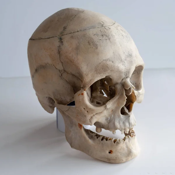 Anatómiai Valódi Emberi Koponyát Közelkép Szög Kilátás Háromnegyed — Stock Fotó