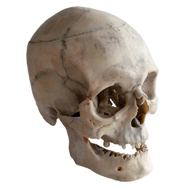 解剖学的 本物の人間の頭蓋骨のクローズ アップ を表示します 白い背景とクリッピング パスの分離 — ストック写真