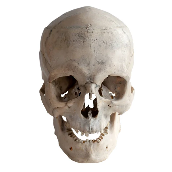 Anatómiai Valódi Emberi Koponyát Közelkép Elülső Kilátás Elszigetelt Fehér Háttér — Stock Fotó