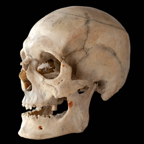 Crânio Humano Vista Lateral Isolado Preto — Fotografia de Stock