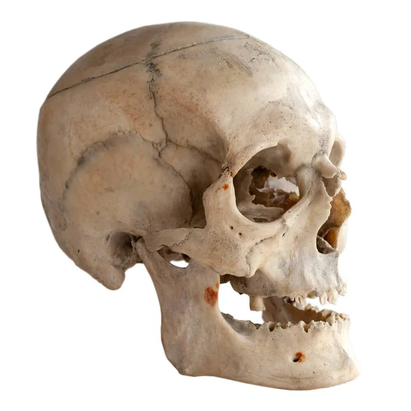 Egy Felnőtt Emberi Koponya Anatómia Oldalnézet Elszigetelt Fehér — Stock Fotó