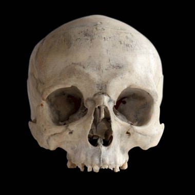 İnsan anatomisi. Bir insan kafatası üzerinde siyah izole yok çenesi. 