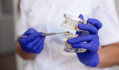 Bir diş hekimi diş ofisinde çene dişörneği tutuyor..