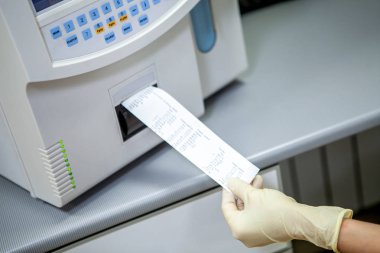 Laboratuvar Sorumlusu alır bir özü kan bileşenleri bileşimi işlemlerden sonra özel bir cihaz, yakın çekim