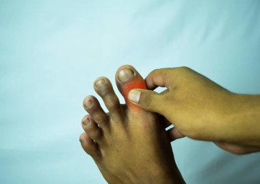 Pain in the joint of big toe can be discouraging clipart