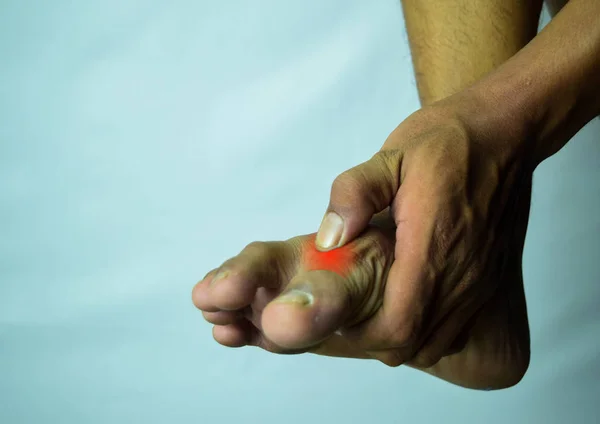 Біль Суглобі Великого Пальця Може Завадити — стокове фото