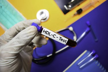 HDL-C kan numunesi ile test. Renk arka planda izole üst görünüm. Sağlık/tıbbi konsept