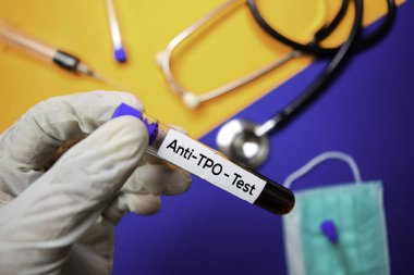 Anti-TPO-kan numunesi ile test. Renk arka planda izole üst görünüm. Sağlık/tıbbi konsept