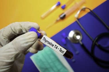 Tiroksin T4-kan numunesi ile test. Renk arka planda izole üst görünüm. Sağlık/tıbbi konsept