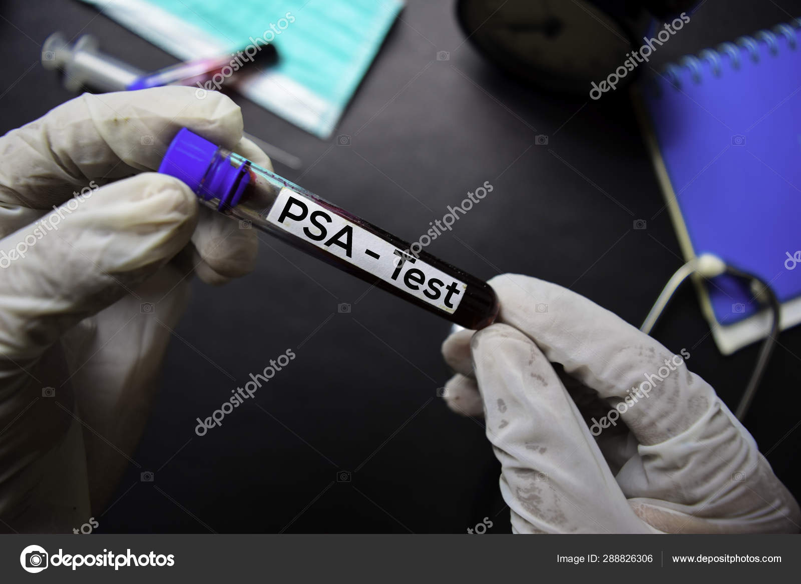 que es el psa en sangre