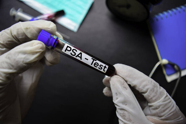 PSA - Test with blood sample. Top view isolated on black background. Healthcare/Medical concept