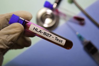 Hla-B27 - Kan örneği ile test edin. Ofis masasında izole üst görünüm. Sağlık / Tıp kavramı