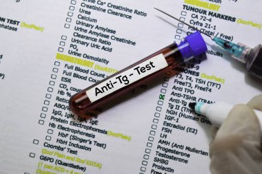 Anti-Tg - Kan örneği ile test edin. Ofis masasında izole üst görünüm. Sağlık / Tıp kavramı
