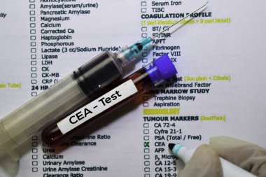 CEA - Test with blood sample. Top view isolated on office desk. Healthcare/Medical concept clipart