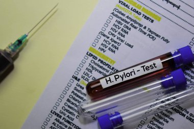 H. Pylori - Kan örneği ile test edin. Ofis masasında izole üst görünüm. Sağlık / Tıp kavramı