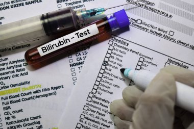 Bilirubin - Kan örneği ile test edin. Ofis masasında izole üst görünüm. Sağlık / Tıp kavramı