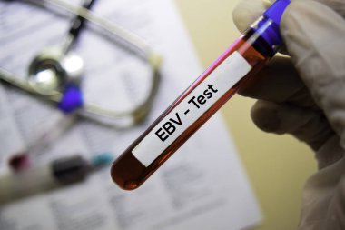 EBV - Test with blood sample. Top view isolated on office desk. Healthcare/Medical concept clipart
