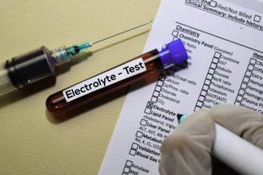 Elektrolit - Kan örneği ile test edin. Ofis masasında izole üst görünüm. Sağlık / Tıp kavramı