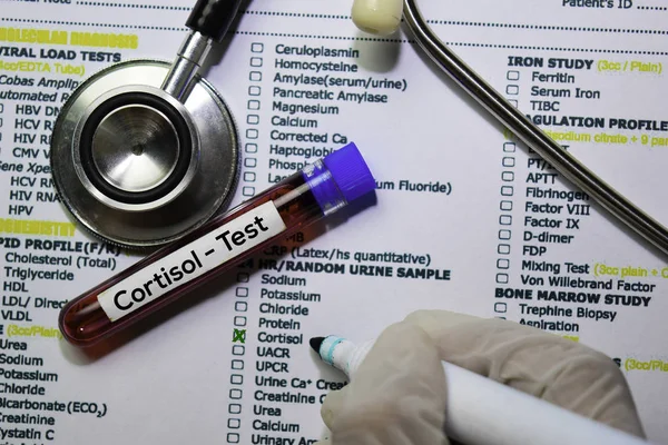 Кортизол - Тест с образцом крови. Вид сверху изолирован на рабочем столе. Здравоохранение / Медицинская концепция — стоковое фото