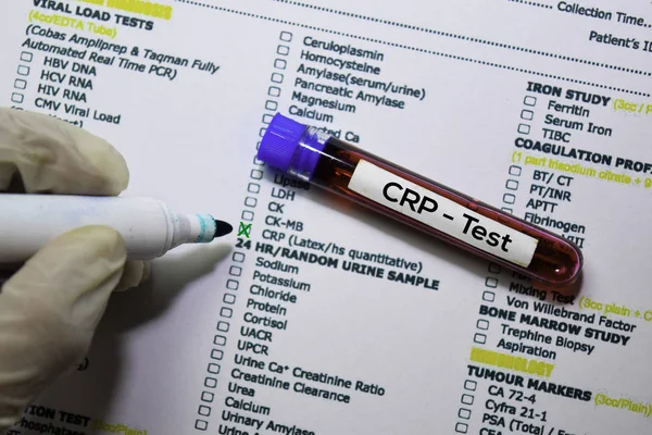 CRP - Тест с образцом крови. Вид сверху изолирован на рабочем столе. Здравоохранение / Медицинская концепция — стоковое фото