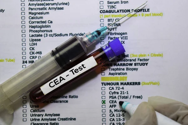 CEA - Тест с образцом крови. Вид сверху изолирован на рабочем столе. Здравоохранение / Медицинская концепция — стоковое фото
