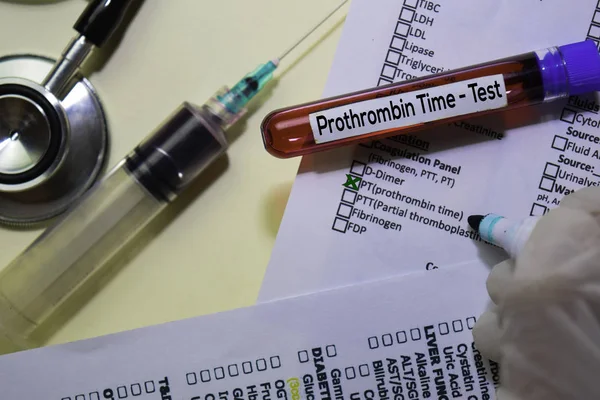 Время протромбина - Тест с образцом крови. Вид сверху изолирован на рабочем столе. Здравоохранение / Медицинская концепция — стоковое фото