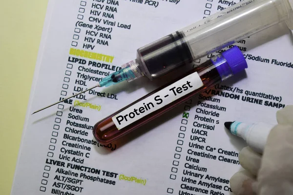 Протеин S - Тест с образцом крови. Вид сверху изолирован на рабочем столе. Здравоохранение / Медицинская концепция — стоковое фото