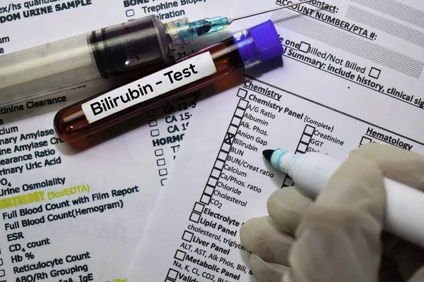 Bilirubin - Test mit Blutprobe. Draufsicht isoliert auf dem Schreibtisch. Gesundheitswesen / medizinisches Konzept — Stockfoto