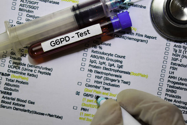 G6PD - Test with blood sample. Top view isolated on office desk. Healthcare/Medical concept