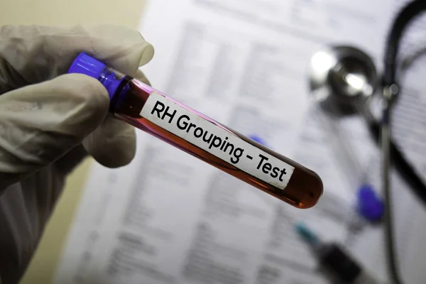 Agrupación RH: prueba con muestra de sangre. Vista superior aislada en el escritorio de la oficina. Salud / Concepto médico — Foto de Stock