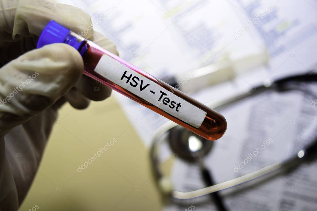 HSV - Test with blood sample. Top view isolated on office desk. Healthcare/Medical concept