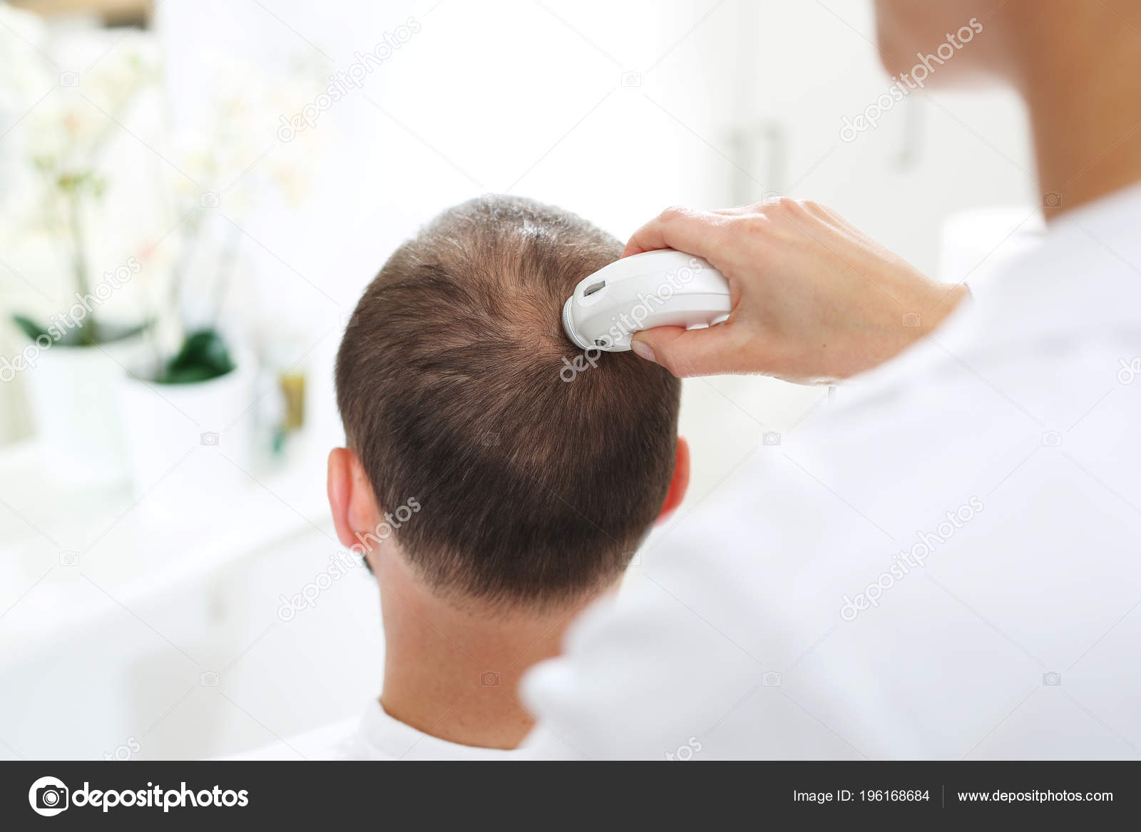 Trichological Examination Head Man Thinning Hair Examination Scalp