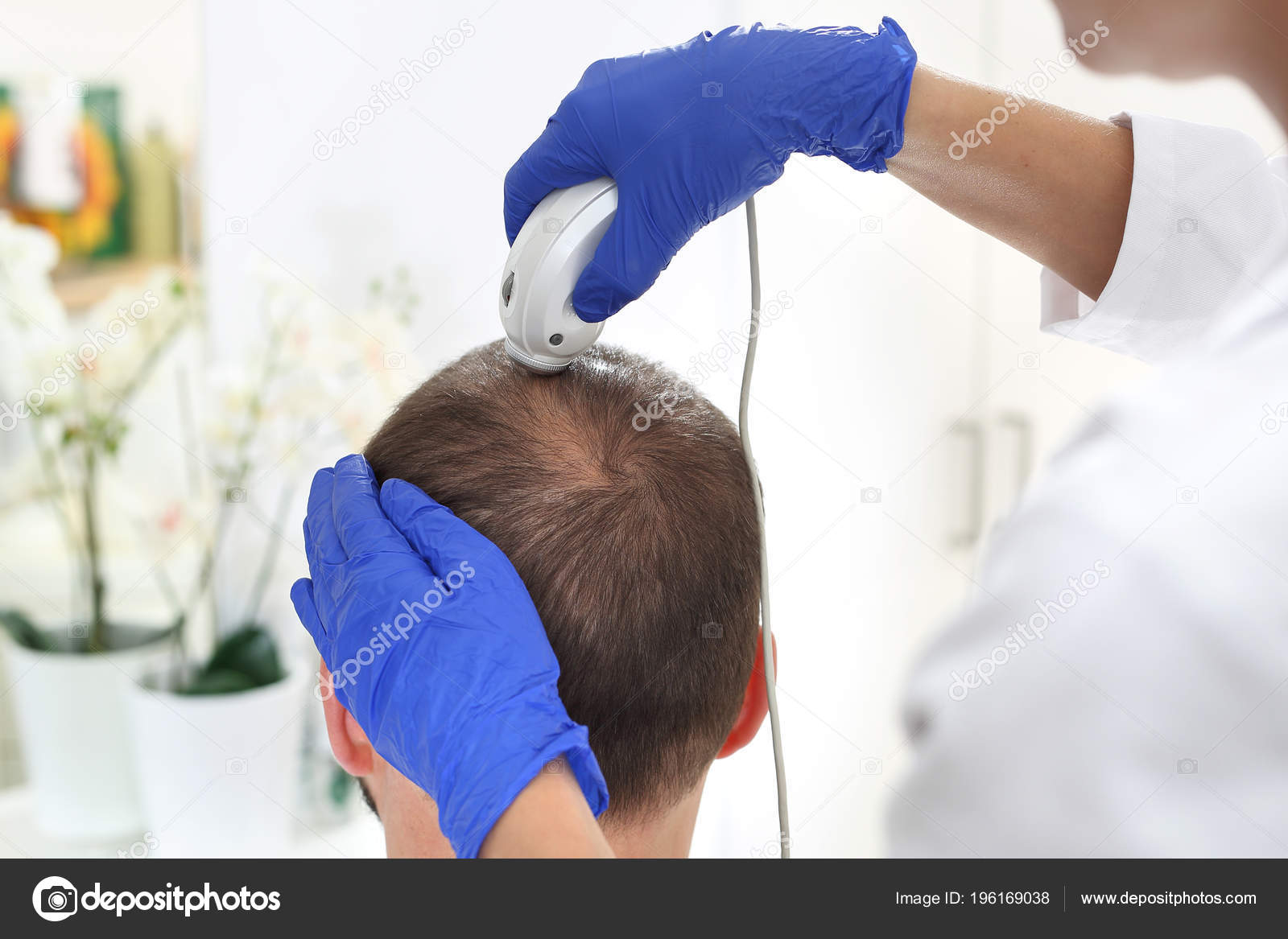 Hair Loss Male Doctor Head Man Thinning Hair Examination Scalp