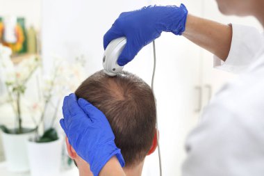 Saç dökülmesi. Erkek doktor. Saç inceltme saç ve kafa derisi muayene sırasında bir mikroskopla ile bir insan kafası