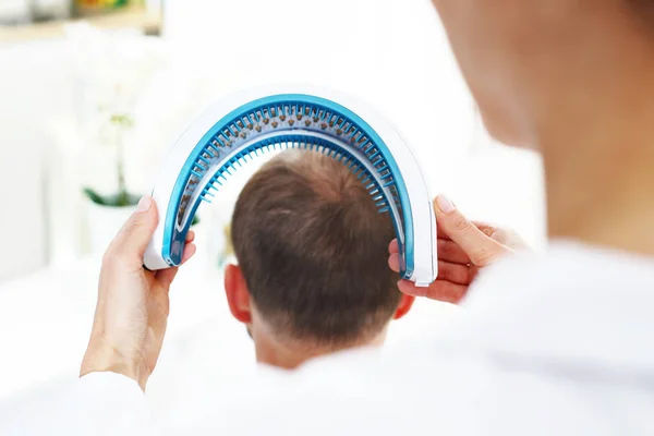 頭皮のレーザー照射 髪玉ねぎを強化のための治療 — ストック写真