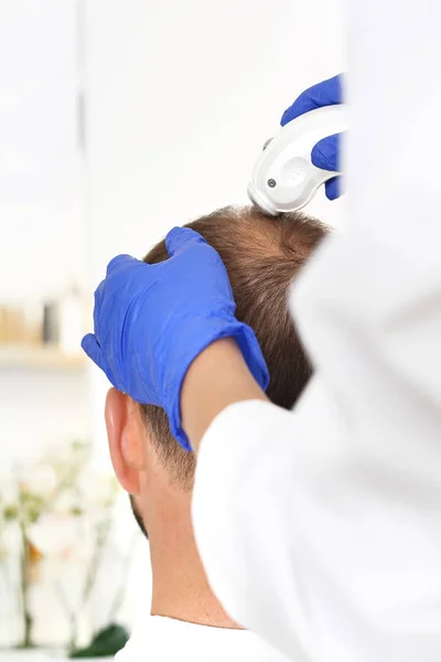 Alopecia Testa Uomo Con Capelli Assottigliati Durante Esame Del Cuoio — Foto Stock