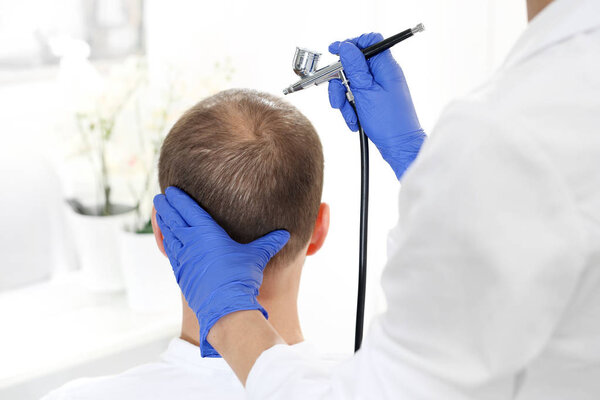 Oxygen therapy of the scalp and hair follicles. The head of a man with thinning hair during a care treatment