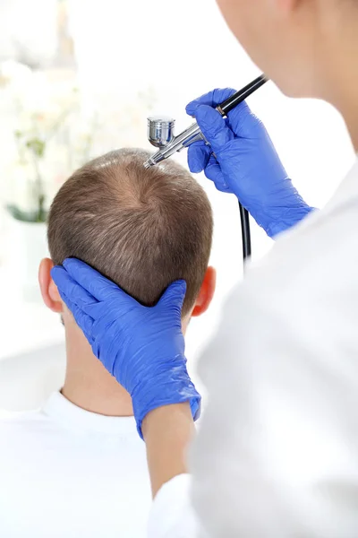 Oxigenoterapia Contra Perda Cabelo Cabeça Homem Com Queda Cabelo Durante — Fotografia de Stock